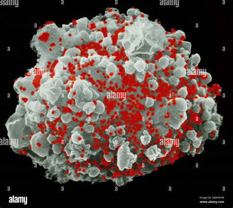 Hiv Infected T Cell Coloured Scanning Electron Micrograph Sem Of A