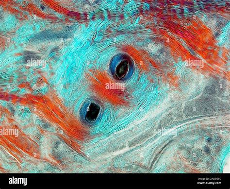 Microscopía de Luz Polarizada sección tangencial de cuero cabelludo