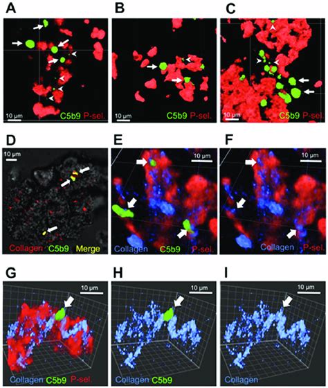 C5b 9 Formation In Collagen Induced Platelet Aggregates Confocal