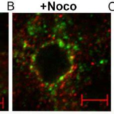 Microtubule And Actin Disruption Completely Disperses Apical MyoVbT