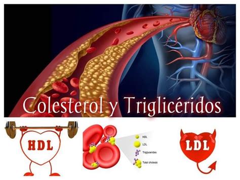 Colesterol y triglicÃridos todo lo que necesitas saber Colesterol y