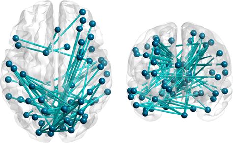 Functional Connection Network Analysis Adjusted For Age Sex Years Of