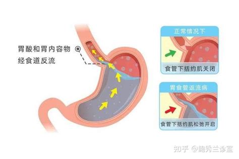 孩子白天不咳晚上咳，7大原因6个对策，照着做就对了 知乎