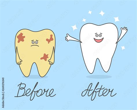 Cartoon tooth before and after cleaning. Comparison of Ill and healthy teeth. Stock Vector ...