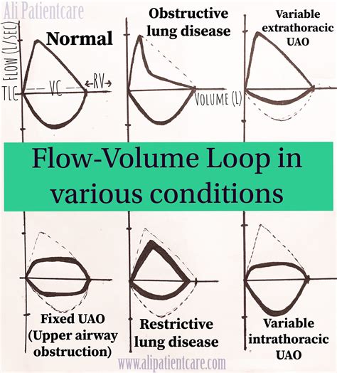 Fixed Obstruction Flow Volume Loop