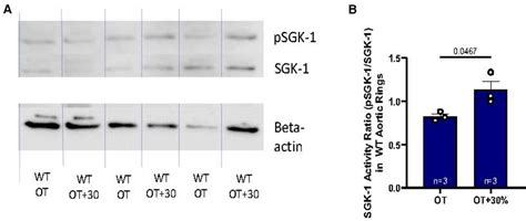 Frontiers Biomechanical Dysregulation Of Sgk Dependent Aortic