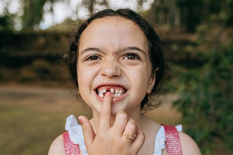 When Do Kids Start Losing Teeth?