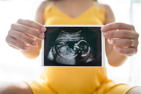 Nub Theory What Is It And How It Predicts Your Babys Sex At Weeks