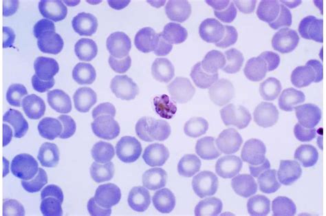 Genome Secrets Of Elusive Human Malaria Species Revealed