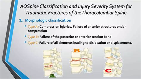 Thoracolumbar Fractures Classification Ppt