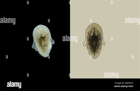 Larva Of The Worm Polycladida Under The Microscope Class Turbellaria Müllers Stock Video