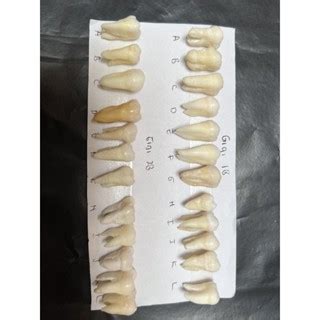 Jual Gigi Molar Rahang Atas Shopee Indonesia