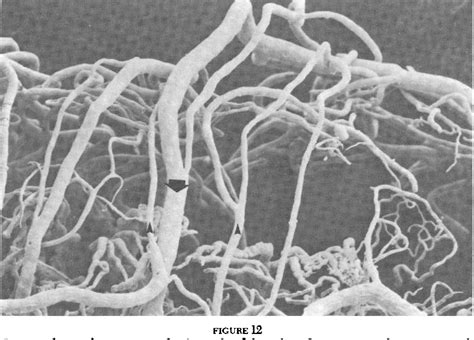 Figure From The Ciliary Vasculature And Its Perturbation With Drugs