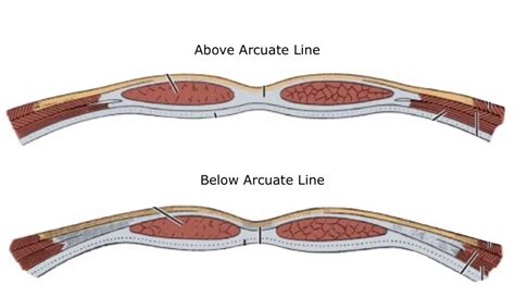 Diagram of Abdo 3: Arcuate Line | Quizlet