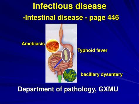 Ppt Infectious Disease Intestinal Disease Page 446 Powerpoint Presentation Id4563438