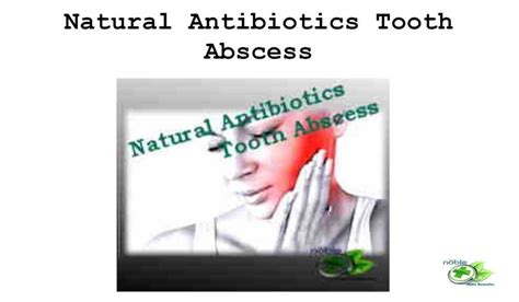 Best Natural Antibiotics Tooth Abscess Symptoms And Treatments