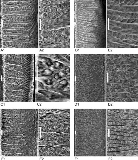 Scanning Electron Photomicrographs Of The Incisor Enamel Microstructure