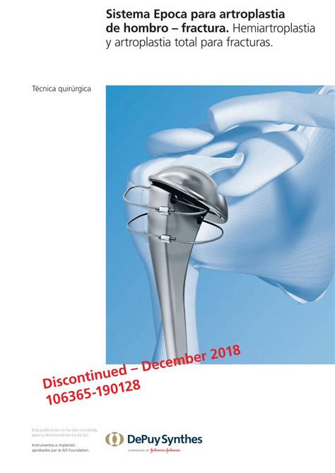 Pdf Sistema Epoca Para Artroplastia De Hombro Fractura Synthes