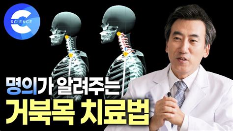 목 디스크를 막는 간단한 거북목 치료방법 | 목 디스크 운동 - YouTube