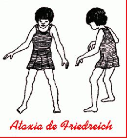 Ataxia De Friedreich Ecured