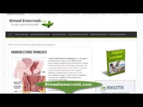 Emorroidi Esterne Trombizzate Cure E Rimedi YouTube