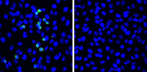 A Novel Defense Mechanism For Sars Cov Discovered Hokkaido University