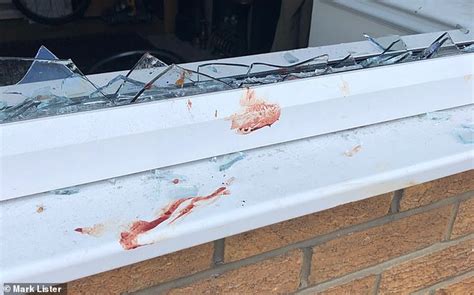 Naked Man Carrying Severed Hand After Escaping House Where He Was Being Held By Abductors