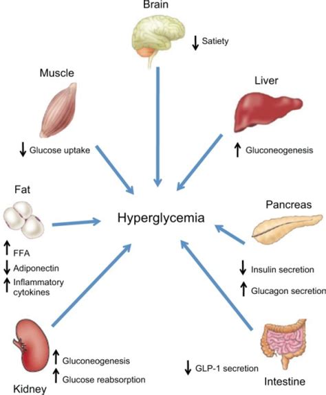 Pathophysiology Of Type 2 Diabetes Mellitus