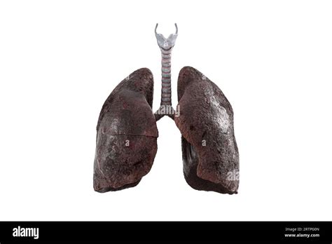 Ilustraci N D Realista De Pulmones Fumadores Enfermos Aislados Sobre