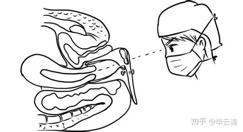 女性多久做一次妇科检查最好？ 知乎
