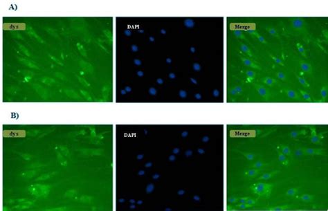 Figure 5 From Dystrophin Gene Editing By CRISPR Cas9 System In Human