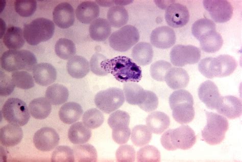 Plasmodium Malariae Sporozoites