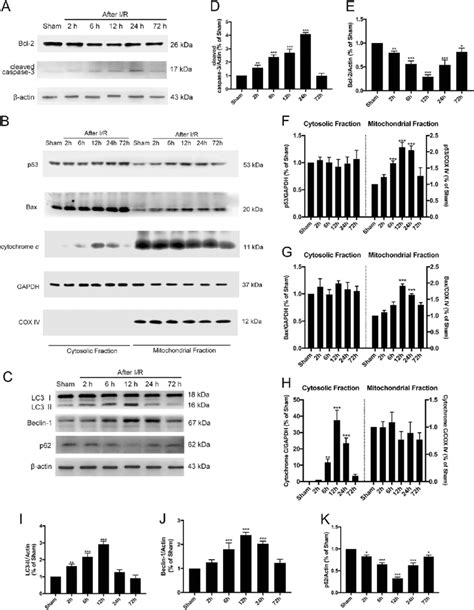 Temporal Changes Of Autophagy And Apoptosis After TGCI A Immunoblots