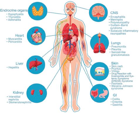 Defining The Correlation Between Immune Checkpoint Inhibitors Related Adverse Events And