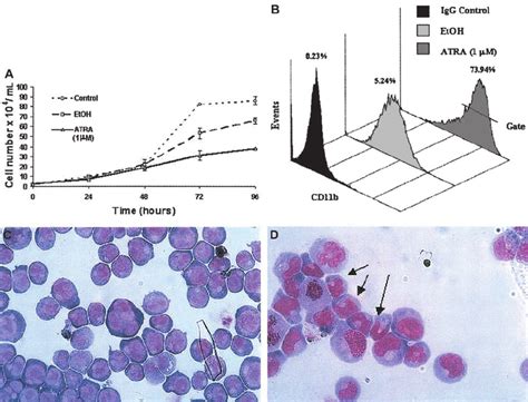 Differentiation of NB4 cells following exposure to ATRA. NB4 cells ...