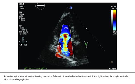 2 Dimensional Transthoracic Echocardiography Download Scientific Diagram