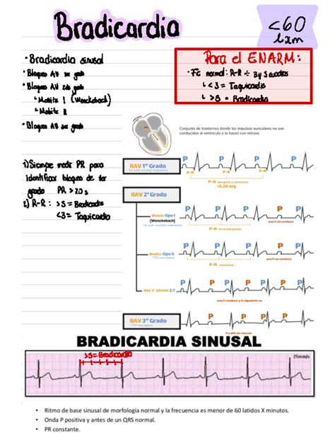 ACLS - Guía para aplicar las guías del acls - Bradicardia