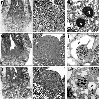 Histological And Ultrastructural Analysis Of Shoot Tip Explants Of