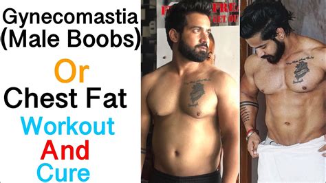 Chest Fat Gyno Gynecomastia Workout And Cure For Men How To Remove