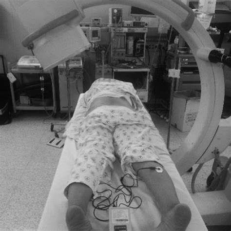 Grading nerve root compression with magnetic resonance imaging. (A)... | Download Scientific Diagram