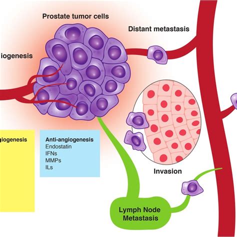 The Role Of Angiogenesis In Tumor Progression Post Natal Angiogenesis