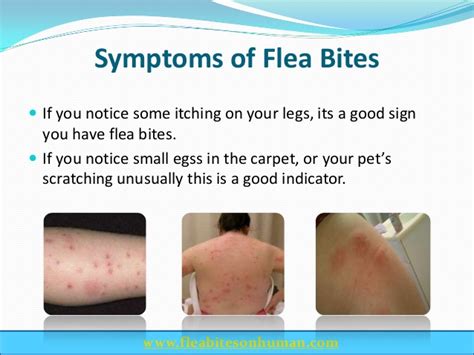 infected flea bite - pictures, photos