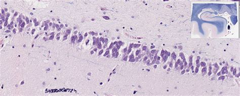 Central Nervous System and Quiz 2 | histology