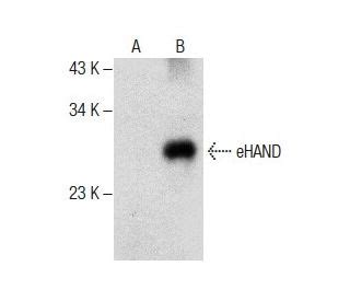 eHAND抗体 F 7 SCBT Santa Cruz Biotechnology