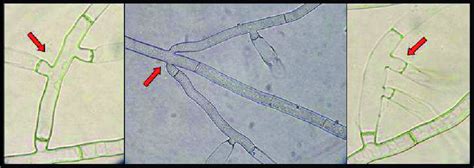 Different Branches Formation Of Some Rhizoctonia Solani Isolates