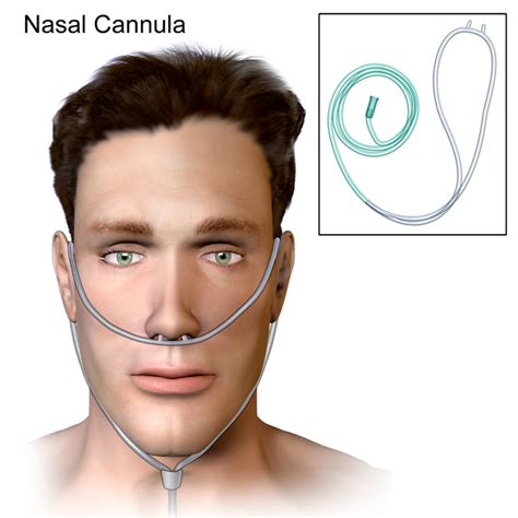 Oxygen Therapy Physiopedia