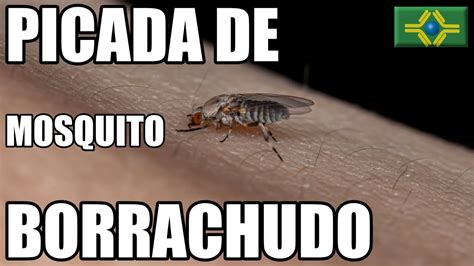 Picada De Borrachudo O Que Passar - PICADA DE BORRACHUDO | Não tinha SENSIBILIDADE a picada do BORRACHUDO ...