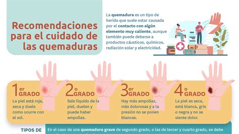 Nuevo Prescribe Recomendaciones Para El Cuidado De Las Quemaduras