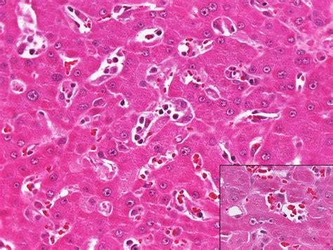 Photomicrography Of The Liver A Diffuse Presence Of Hemophagocytic Download Scientific