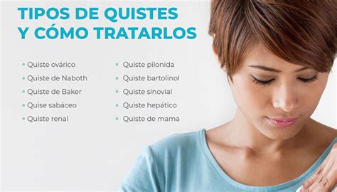 Tipos De Quistes Y C Mo Tratarlos Ccm Consultas